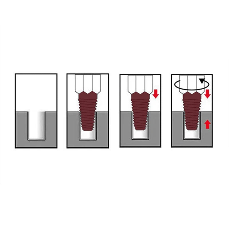 Illustration of a dental implant installation process with arrows indicating steps.