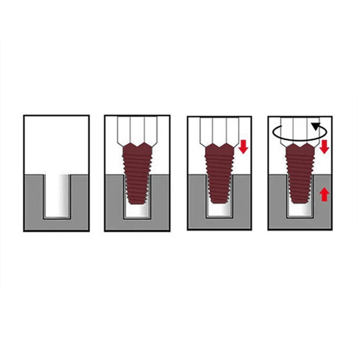 Illustration of a dental implant installation process with arrows indicating steps.